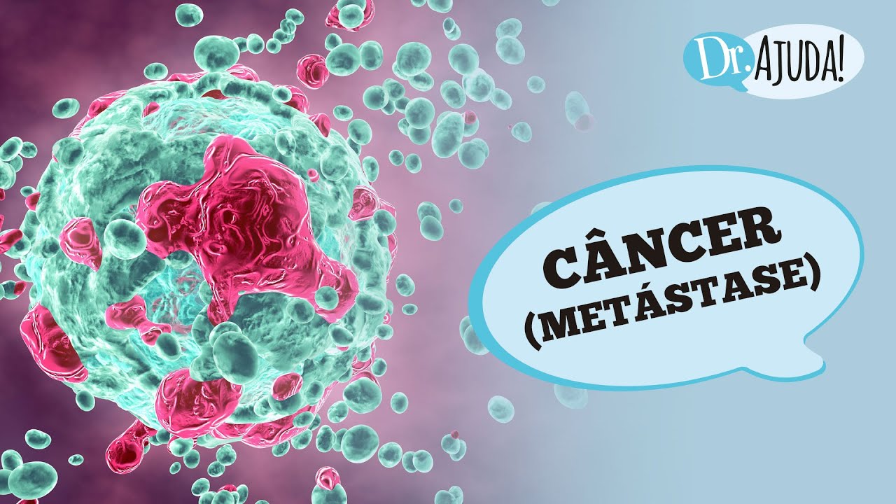 Metástase do Câncer: o que é, diagnóstico e tratamento