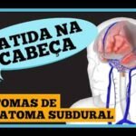Batida na cabeça: sintomas de hemorragia subdural