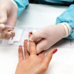 Luta contra o HIV: nesta segunda (1º), SCS oferece testagem rápida