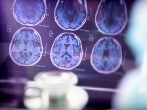 Diagnóstico precoce do Alzheimer ajuda pacientes e famílias a viverem com mais qualidade