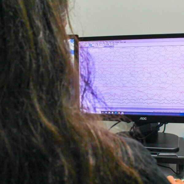 Tratamento para epilepsia leva qualidade de vida a crianças e&hellip;