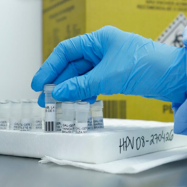 Novo teste amplia a detecção precoce do câncer de colo&hellip;
