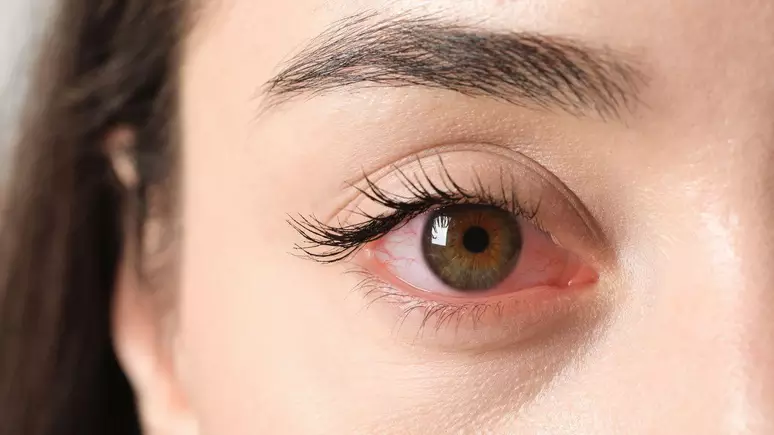 Visão embaçada? Veja como proteger a saúde dos olhos com&hellip;
